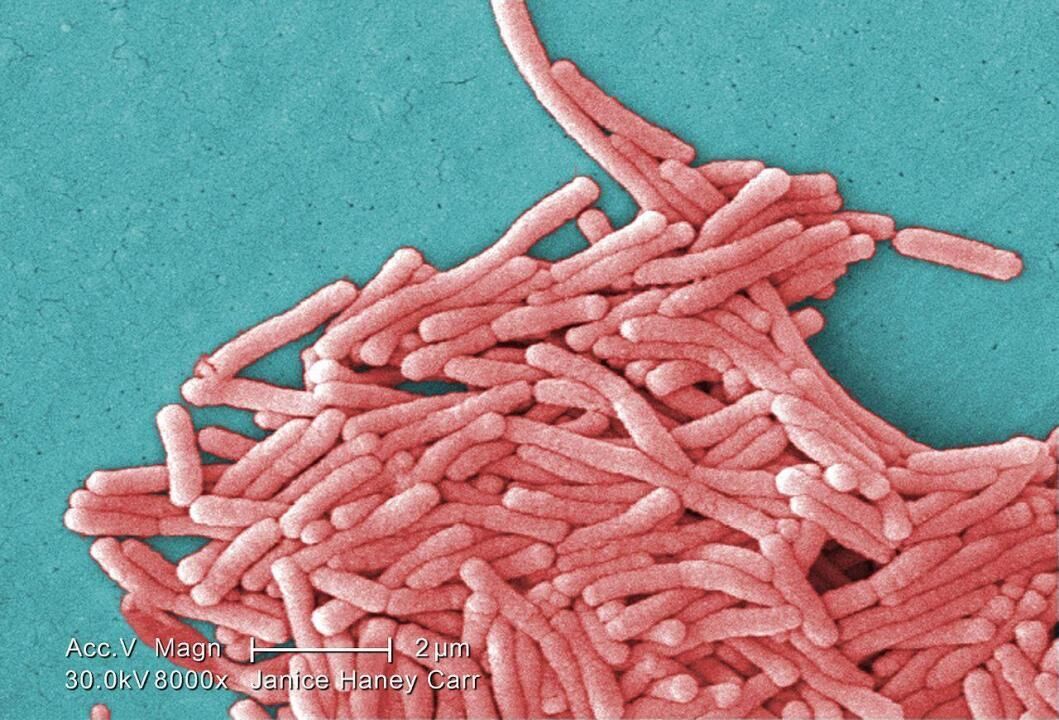 Legionella